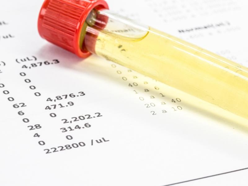 Toxicológico Positivo no ASO Periódico: O que Fazer?