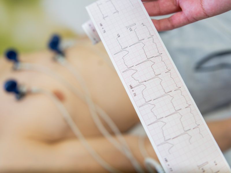 EXAME DE ELETROCARDIOGRAMA